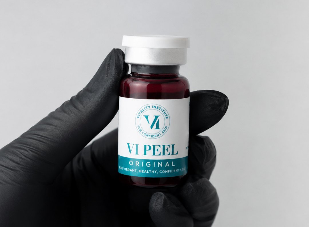 A gloved hand holding a VI Peel Original vial at Anato Aesthetics in Scottsdale